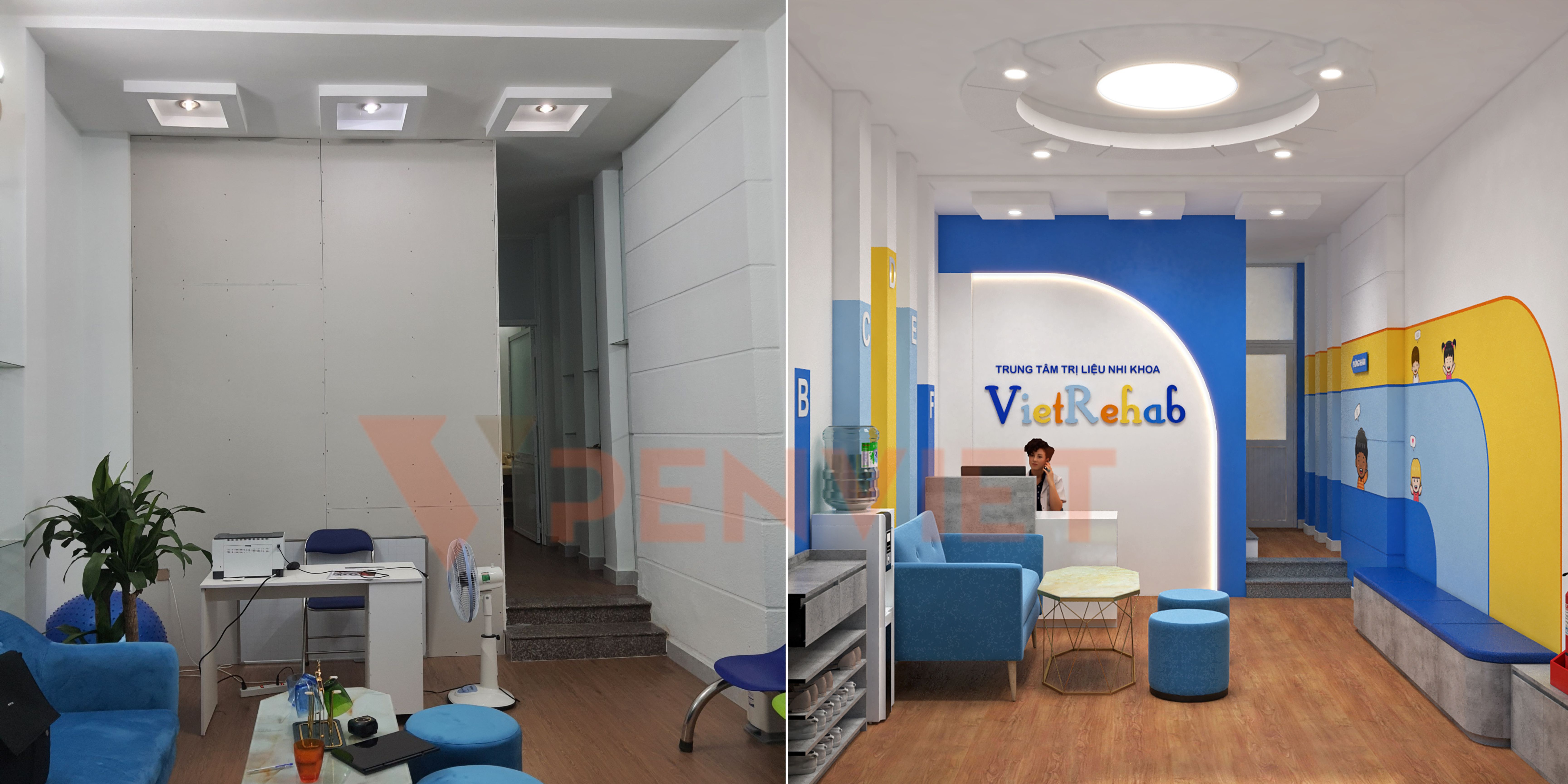 Trước và sau khi thiết kế phòng khám vật lí trị liệu cho bé