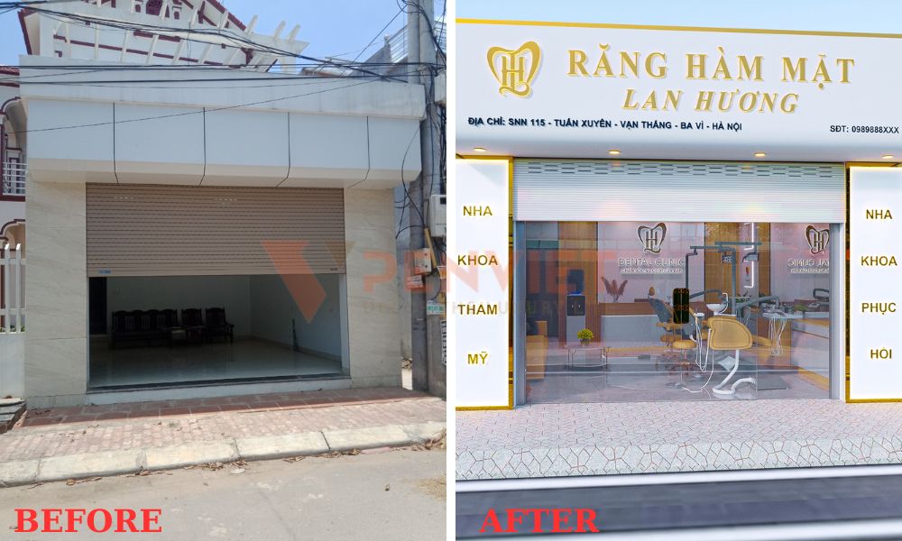 Trước và sau khi thiết kế mặt tiền phòng khám răng hàm mặt