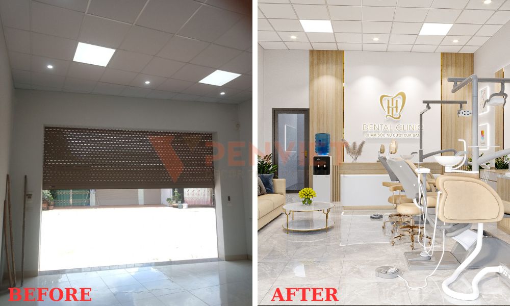 Hiện trang trước sau khi thiết kế phòng khám răng hàm mặt